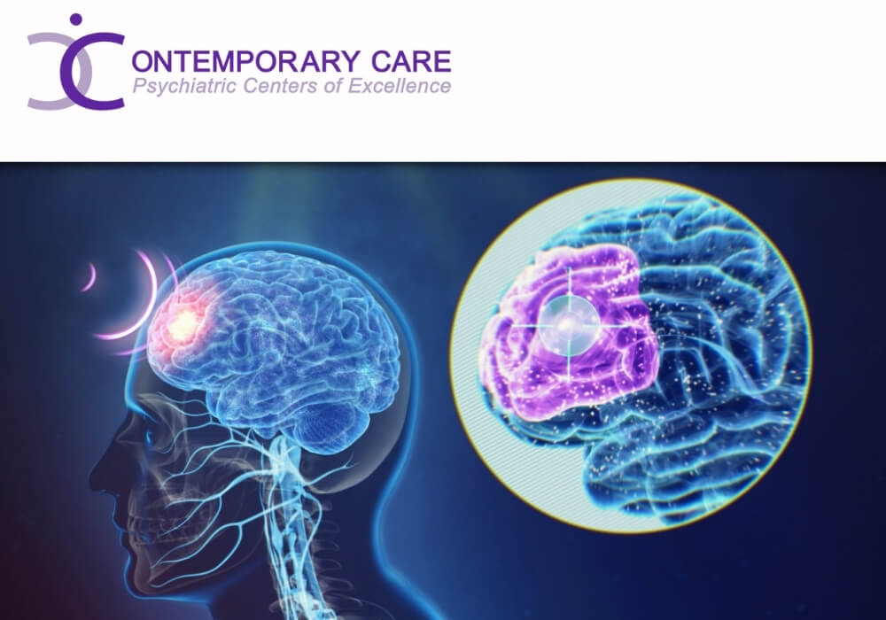 TMS therapy for mental issues